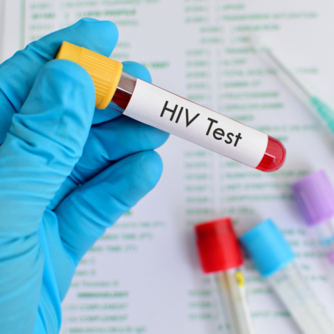 Gloved hand holding a vial of blood labeled "HIV Test"